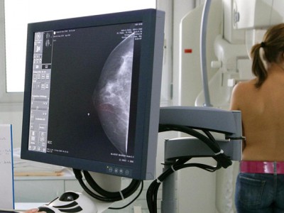 Маммография – безопасный и надежный метод скрининга и диагностики рака молочной железы.